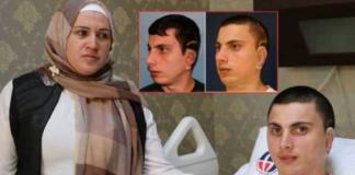Врачи в Турции создали пациенту ушную раковину из ребра его матери