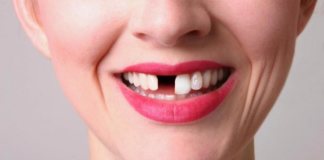 Выпавшие зубы расскажут, сколько осталось жить человеку