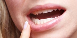 Для пожилых женщин болезни десен смертельно опасны