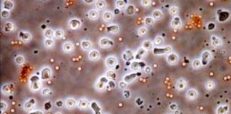 Открытие немецких ученых позволит создать новые лекарства от аллергии и бронхиальной астмы